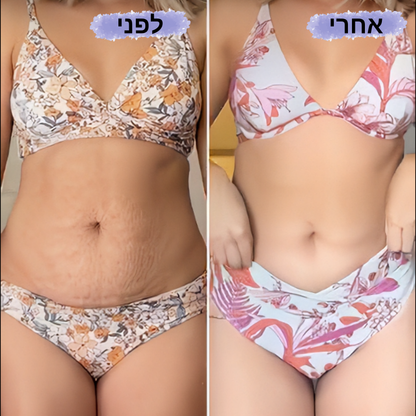 VERNA PRO - מכשיר לטיפול בצלוליט