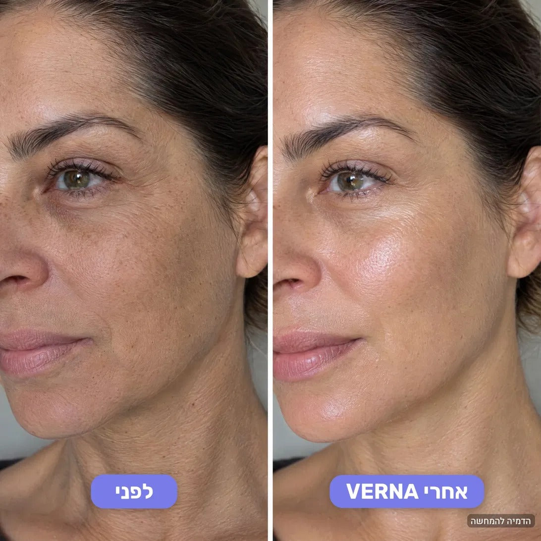 VERNA Stick - סטיק לטיפול בקמטים
